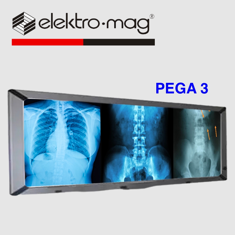 ELEKTROMAG XRAY VIEWER (3 BANK) PEGA III
